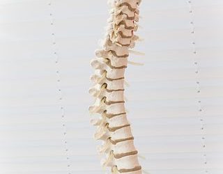 How Can I Fix Scoliosis Naturally?
