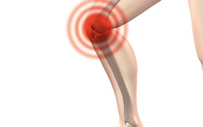 Osgood Schlatter: A Misdiagnosed Condition