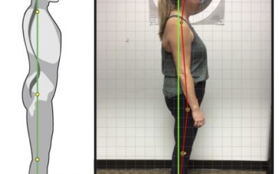 Why Is Posture Important?