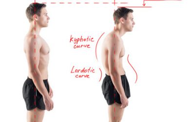 How to Have Good Posture Without A Posture Corrector