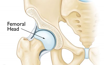 Understanding and Preventing Hip Pain Before It Leads to Surgery