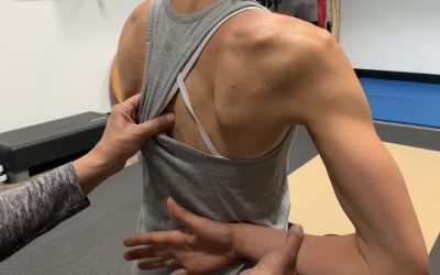3 Must Do’s in the Treatment Of Pinched Nerve